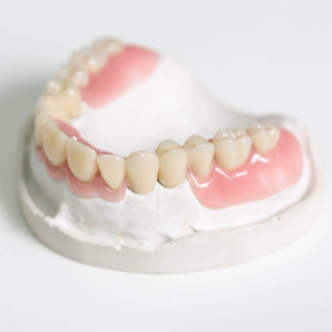 スマイルデンチャー