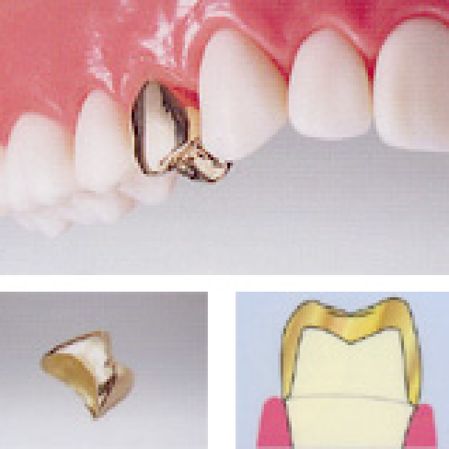 ゴールドクラウン