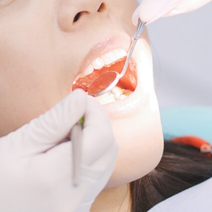 継続的なフォローアップ