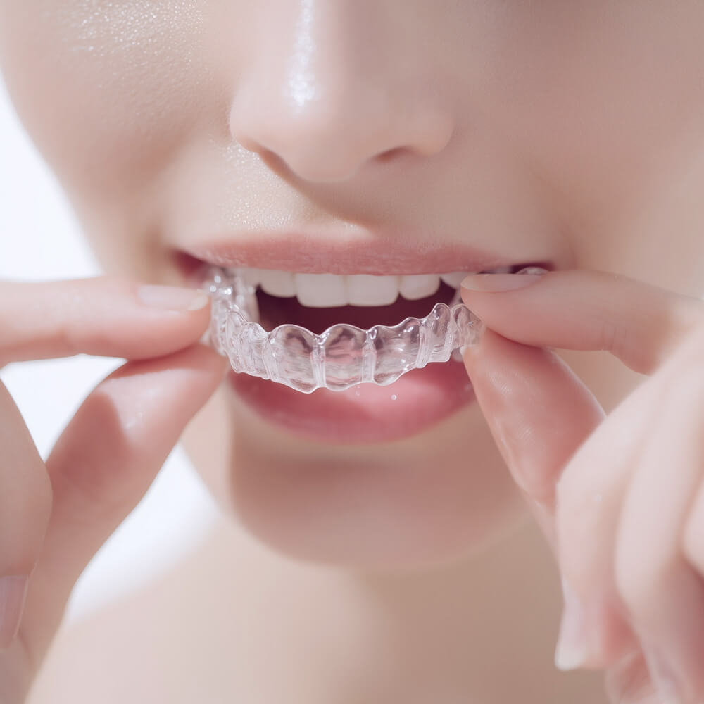 おすすめする理由